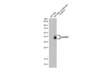 IGFBP3 Recombinant Rabbit Monoclonal Antibody (HL1505)