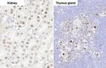 PARP3 Antibody in Immunohistochemistry (Paraffin) (IHC (P))