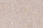 TRPV2 Antibody in Immunohistochemistry (Paraffin) (IHC (P))