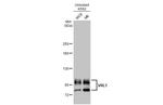 TRPV2 Antibody in Western Blot (WB)