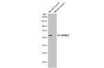 KPNA3 Antibody in Western Blot (WB)