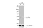 NDUFV1 Antibody in Western Blot (WB)