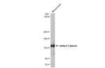Catenin delta-2 Antibody in Western Blot (WB)