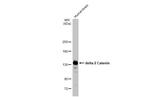 Catenin delta-2 Antibody in Western Blot (WB)