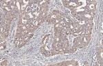 Lass2 Antibody in Immunohistochemistry (Paraffin) (IHC (P))