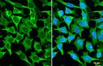 MUC2 Recombinant Rabbit Monoclonal Antibody (HL1724)