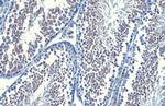 B-Raf Recombinant Rabbit Monoclonal Antibody (HL1735)