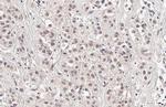 SESN1 Recombinant Rabbit Monoclonal Antibody (HL1750)