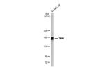 TNIK Antibody in Western Blot (WB)