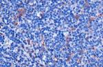 IL-18 Recombinant Rabbit Monoclonal Antibody (HL1761)