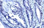 ADAR1 Recombinant Rabbit Monoclonal Antibody (HL1789)