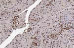 METTL14 Antibody in Immunohistochemistry (Paraffin) (IHC (P))