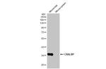 CRALBP Recombinant Rabbit Monoclonal Antibody (HL1834)
