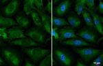 YTHDC2 Recombinant Rabbit Monoclonal Antibody (HL1861)
