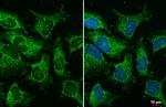 YTHDC2 Recombinant Rabbit Monoclonal Antibody (HL1862)
