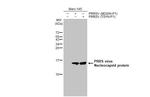 PRRS Virus Nucleocapsid Protein Antibody in Western Blot (WB)