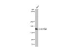 Ataxin 2 Antibody in Western Blot (WB)