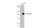 Collagen III Recombinant Rabbit Monoclonal Antibody (HL1908)