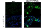 SARS-CoV-2 ORF9b Recombinant Rabbit Monoclonal Antibody (HL1917)