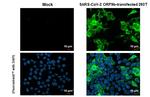 SARS-CoV-2 ORF9b Recombinant Rabbit Monoclonal Antibody (HL1918)