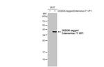 Enterovirus 71 VP1 Recombinant Rabbit Monoclonal Antibody (HL1928)
