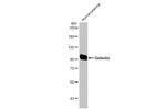 Gelsolin Recombinant Rabbit Monoclonal Antibody (HL1931)