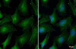 Vinculin Recombinant Rabbit Monoclonal Antibody (HL1964)