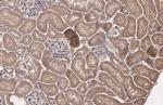 HHIP Antibody in Immunohistochemistry (Paraffin) (IHC (P))