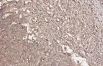 HHIP Recombinant Rabbit Monoclonal Antibody (HL1969)