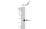 IGF2 Recombinant Rabbit Monoclonal Antibody (HL1979)