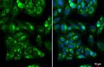 IGF2 Recombinant Rabbit Monoclonal Antibody (HL1982)
