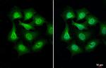 PIP5K1A Recombinant Rabbit Monoclonal Antibody (HL2011)