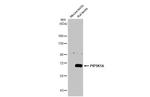 PIP5K1A Antibody in Western Blot (WB)