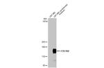 COL1A2 Antibody in Western Blot (WB)