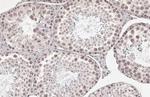 BRPF1 Recombinant Rabbit Monoclonal Antibody (HL2064)