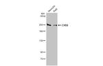 CHD2 Antibody in Western Blot (WB)