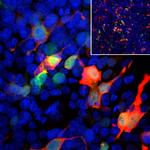 GFP Antibody in Immunocytochemistry (ICC/IF)