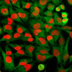 HMGB1 Monoclonal Antibody (1F3)