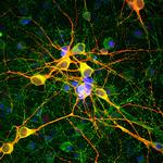 Tau Monoclonal Antibody (2E9)