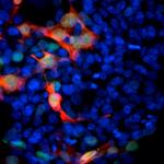 GFP Antibody in Immunocytochemistry (ICC/IF)