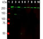 SPTAN1 Antibody in Western Blot (WB)