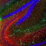 GFAP Antibody in Immunohistochemistry (PFA fixed) (IHC (PFA))