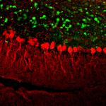 Calretinin Monoclonal Antibody (3G9)
