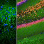 MAP2 Monoclonal Antibody (4H5)
