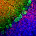 Calbindin D28K Monoclonal Antibody (4H7)