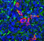 Cas12j Antibody in Immunocytochemistry (ICC/IF)
