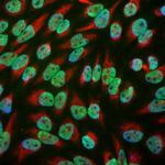 EWSR1 Monoclonal Antibody (5H7)