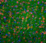 NEFL Monoclonal Antibody (6H112)