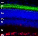 Rhodopsin Monoclonal Antibody (B630)