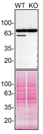 EPHX2 Antibody in Western Blot (WB)